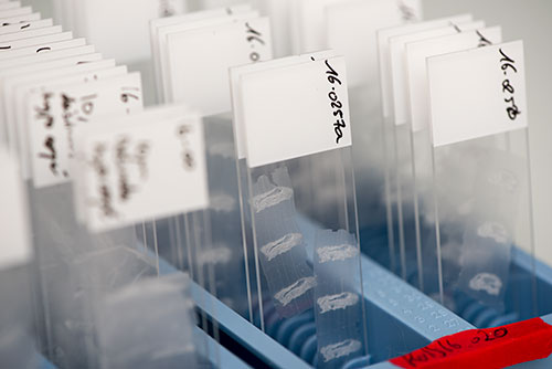HistoSkin® slides to study FFPE stained skin sections