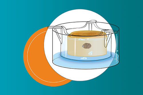 Oncoskin human skin cancer model