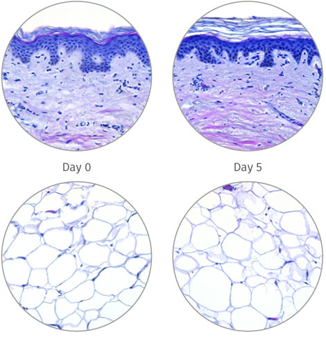 HypoSkin® - human skin model for 