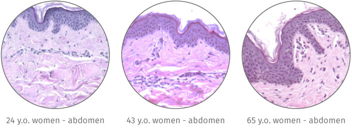 Microscopic view HistoSkin® FFPE human skin tissue section