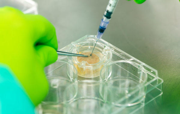 Injection of blue colorant into HypoSkin, one of our ex vivo human skin models