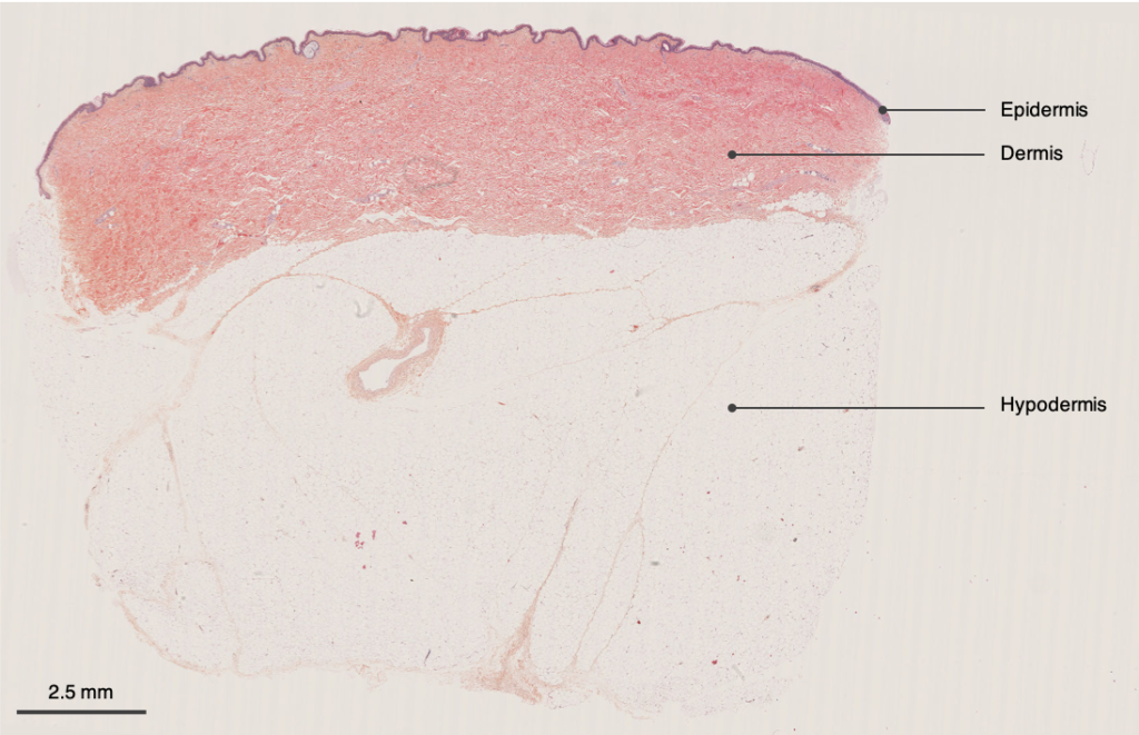 H&E staining of HypoSkin® model