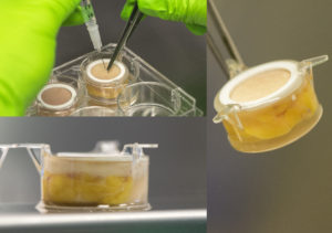 HypoSkin® montage with injection and close up of the subcutaneous injection model